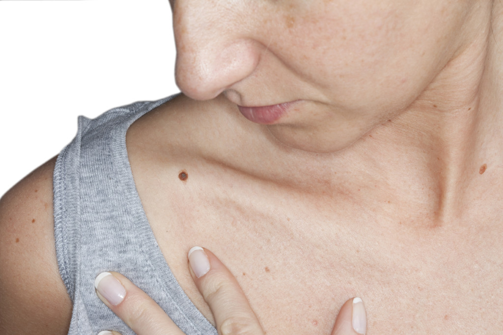 Рак кожи: симптомы и признаки