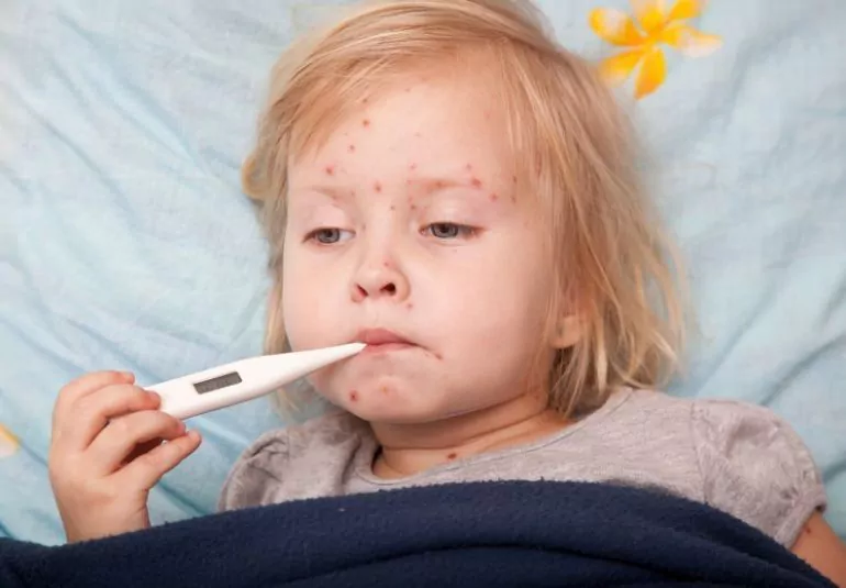 Аллергия у малышей